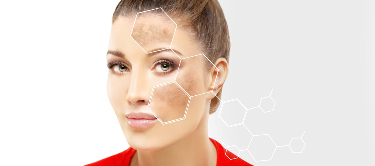 FAQ: Can Hyperpigmentation Go Away Naturally?